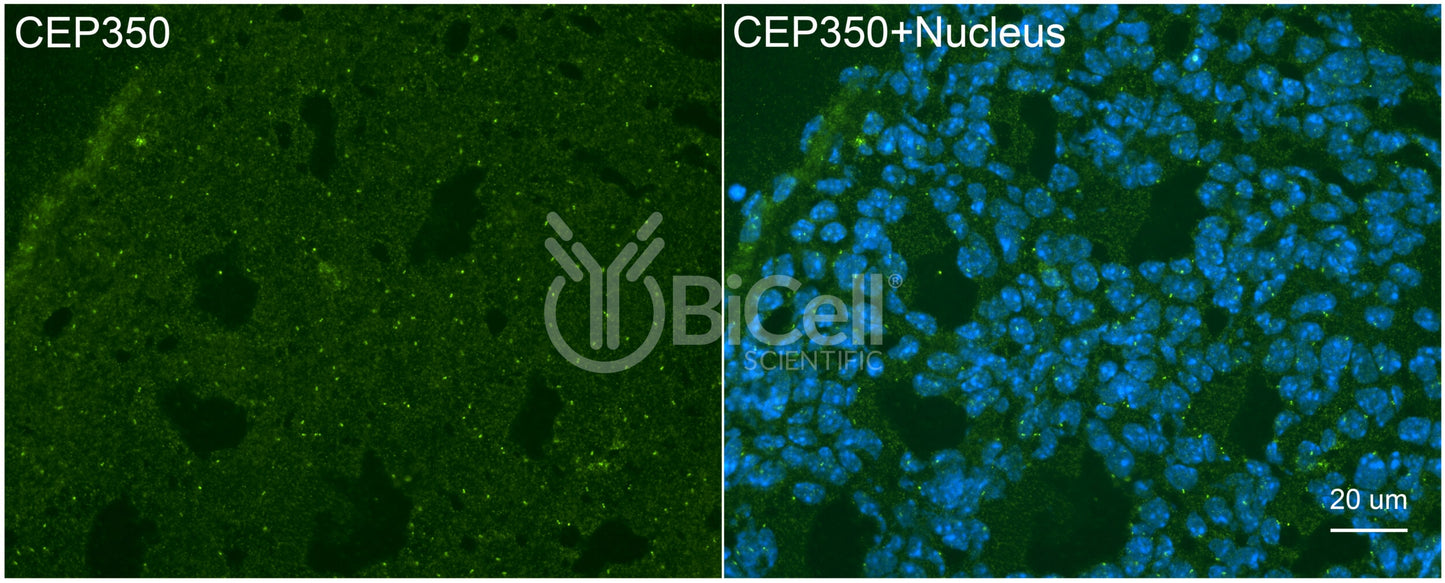 CEP350 Antibody - Western Blot Validated