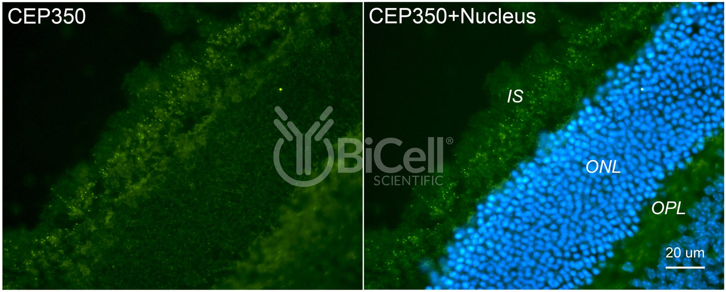 CEP350 Antibody - FFPE Validated