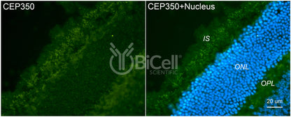 CEP350 Antibody - FFPE Validated