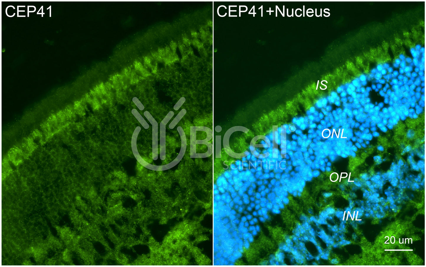 CEP41 (TSGA14) Antibody