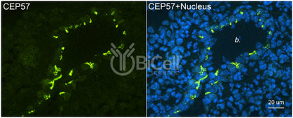 CEP57 Antibody - Western Blot Validated