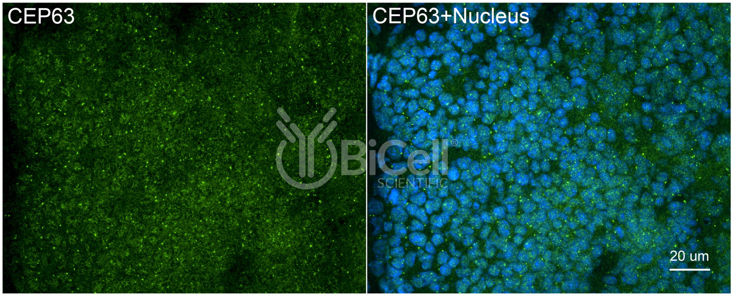 CEP63 Antibody - Western Blot Validated