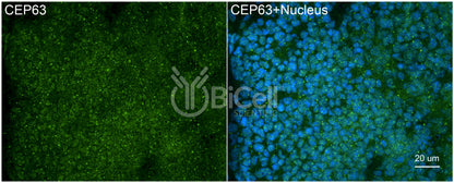 CEP63 Antibody - FFPE Validated