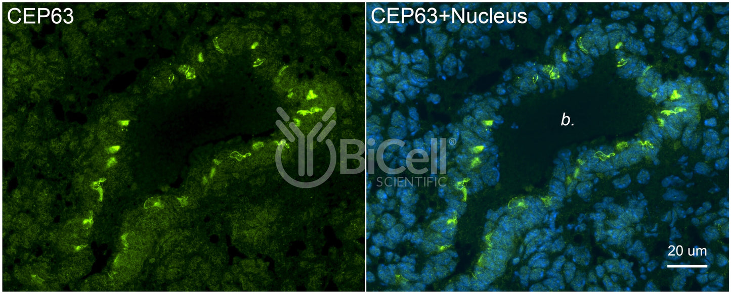 CEP63 Antibody - Western Blot Validated
