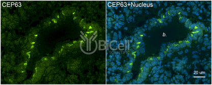 CEP63 Antibody - FFPE Validated