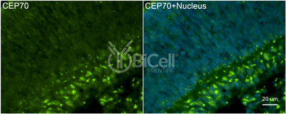 CEP70 Antibody - FFPE Validated