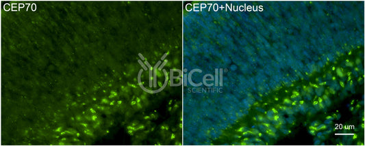 CEP70 Antibody - FFPE Validated