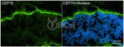 CEP70 Antibody - FFPE Validated