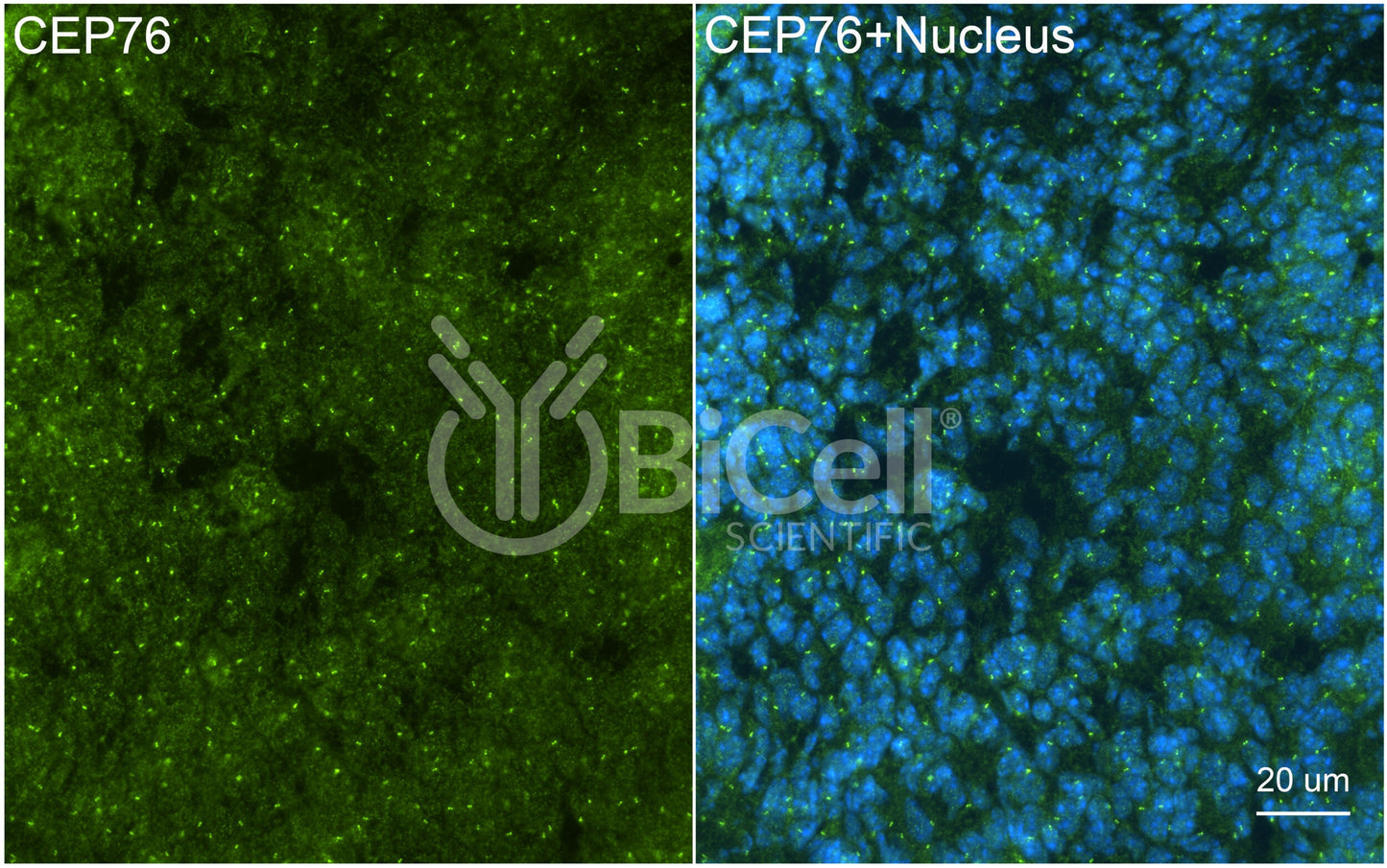 CEP76 Antibody - FFPE Validated