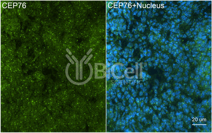 CEP76 Antibody - FFPE Validated