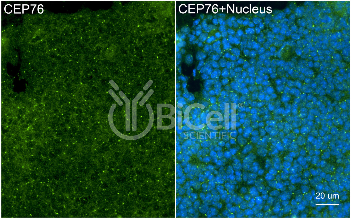 CEP76 Antibody - FFPE Validated
