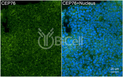 CEP76 Antibody - FFPE Validated
