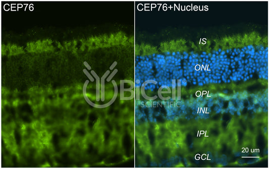 CEP76 Antibody