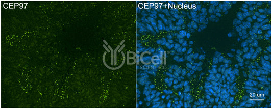 CEP97 Antibody - FFPE Validated