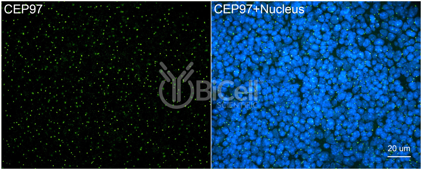 CEP97 Antibody - FFPE Validated