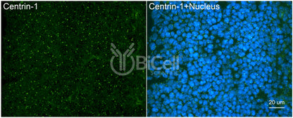 Centrin-1 Antibody - FFPE Validated