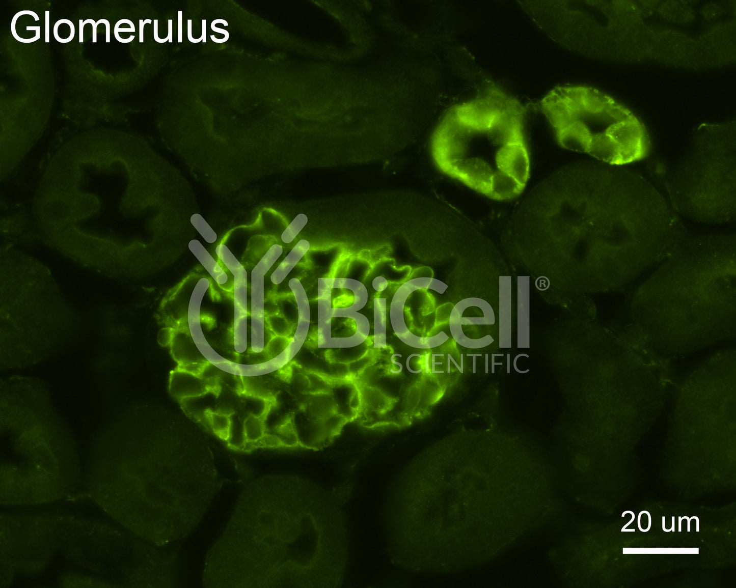 CFTR Antibody