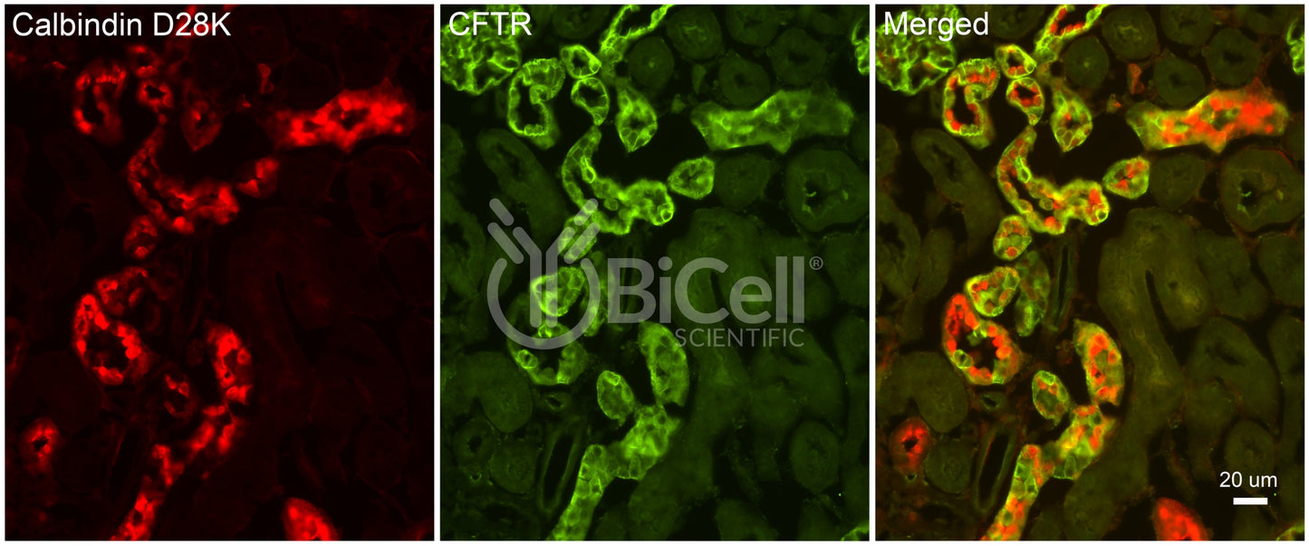 CFTR Antibody