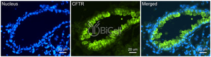 CFTR Antibody - FFPE Validated