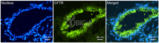 CFTR Antibody - FFPE Validated