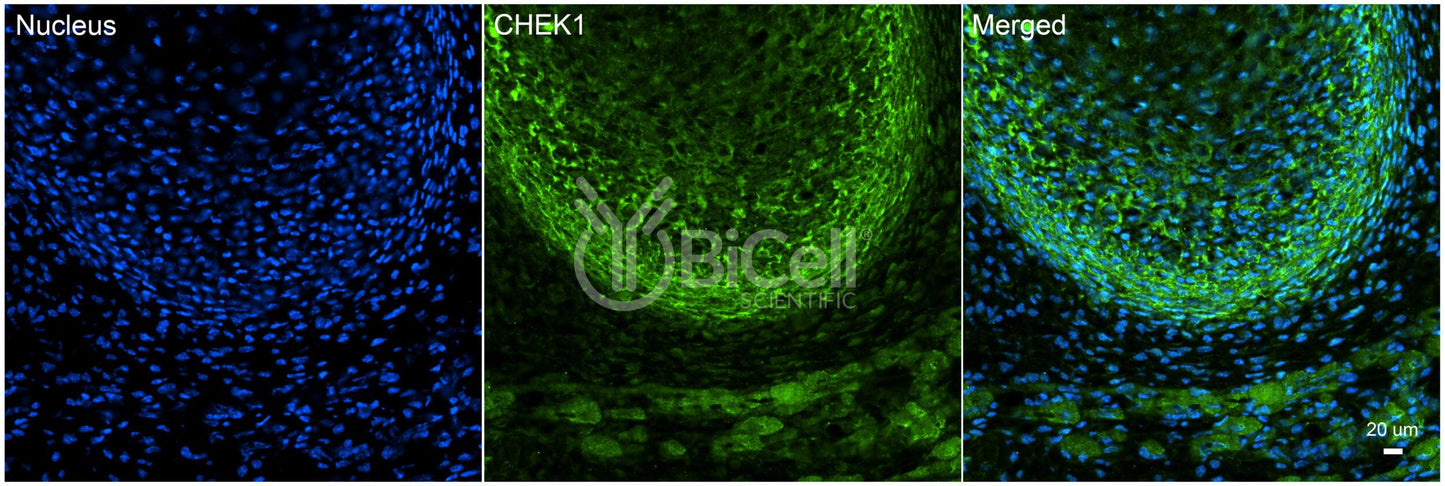 CHEK1 (CHK1) Antibody - Western Blot Validated