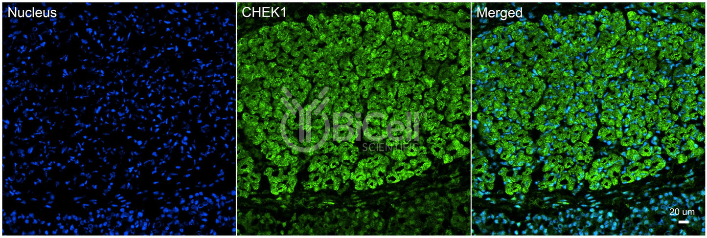 CHEK1 (CHK1) Antibody