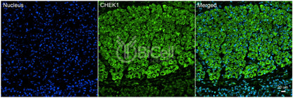 CHEK1 (CHK1) Antibody
