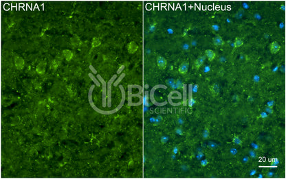 CHRNA1 (ACHRA) Antibody - Western Blot Validated