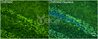 CHRNA2 Antibody - FFPE Validated
