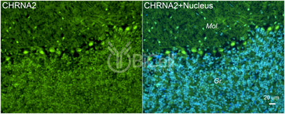 CHRNA2 Antibody - FFPE Validated