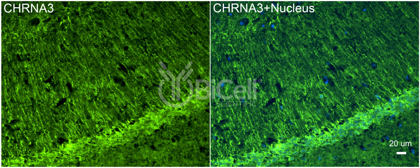 CHRNA3 (NACHRA3) Antibody - FFPE Validated