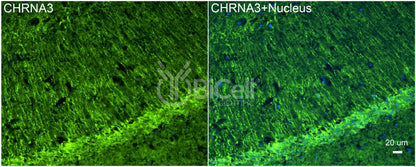 CHRNA3 (NACHRA3) Antibody - FFPE Validated