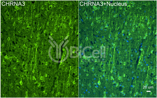CHRNA3 (NACHRA3) Antibody - FFPE Validated