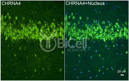 CHRNA4 (NACHRA4) Antibody - Western Blot Validated