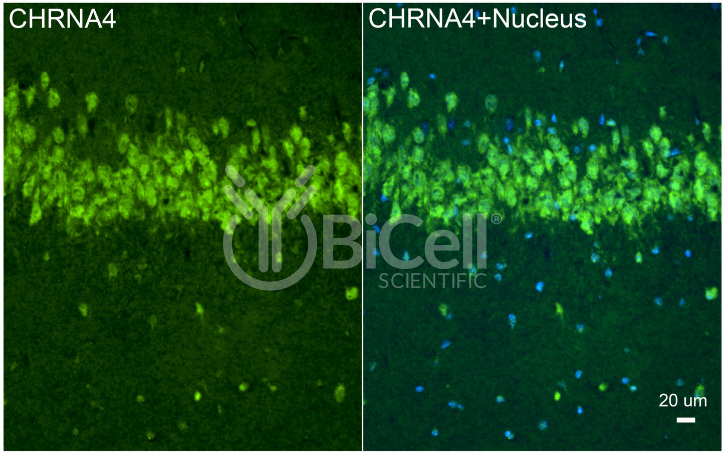 CHRNA4 (NACHRA4) Antibody
