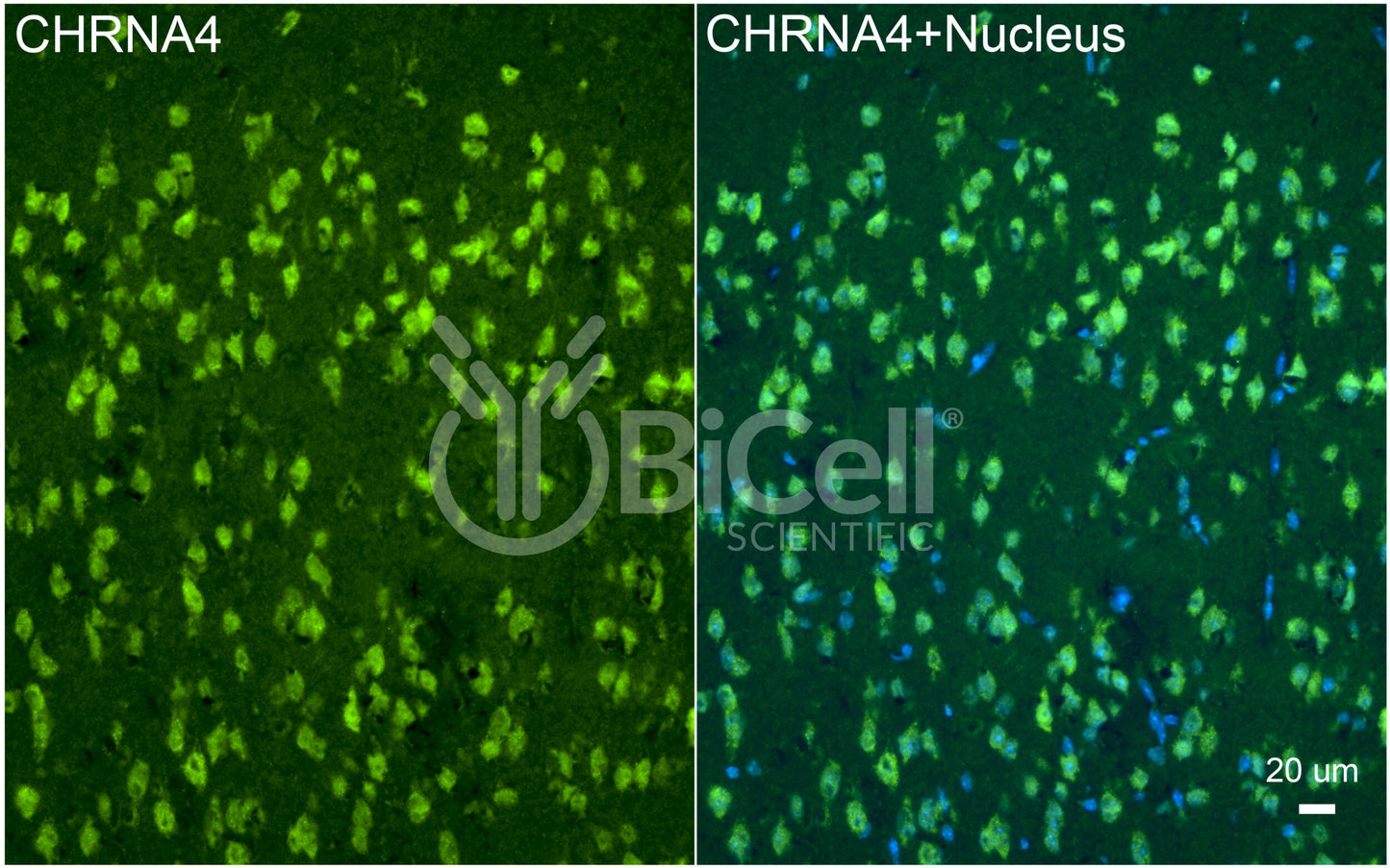 CHRNA4 (NACHRA4) Antibody