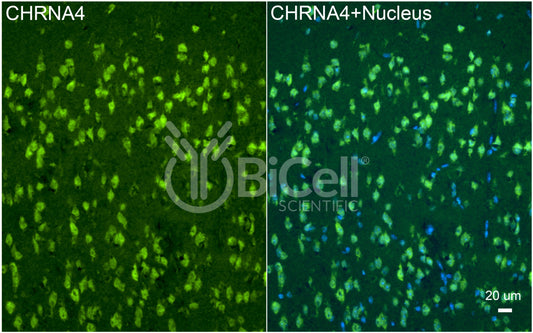 CHRNA4 (NACHRA4) Antibody - FFPE Validated