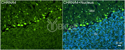 CHRNA4 (NACHRA4) Antibody - FFPE Validated