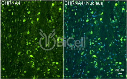 CHRNA4 (NACHRA4) Antibody - Western Blot Validated