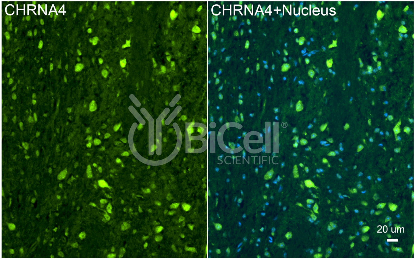 CHRNA4 (NACHRA4) Antibody