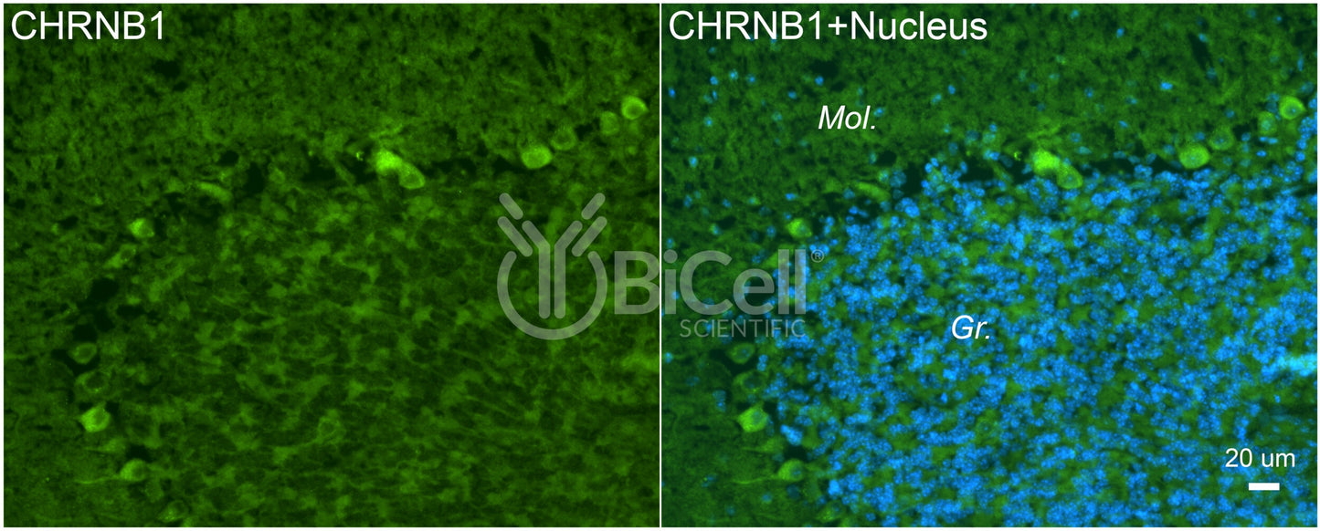 CHRNB1 (ACHRB) Antibody