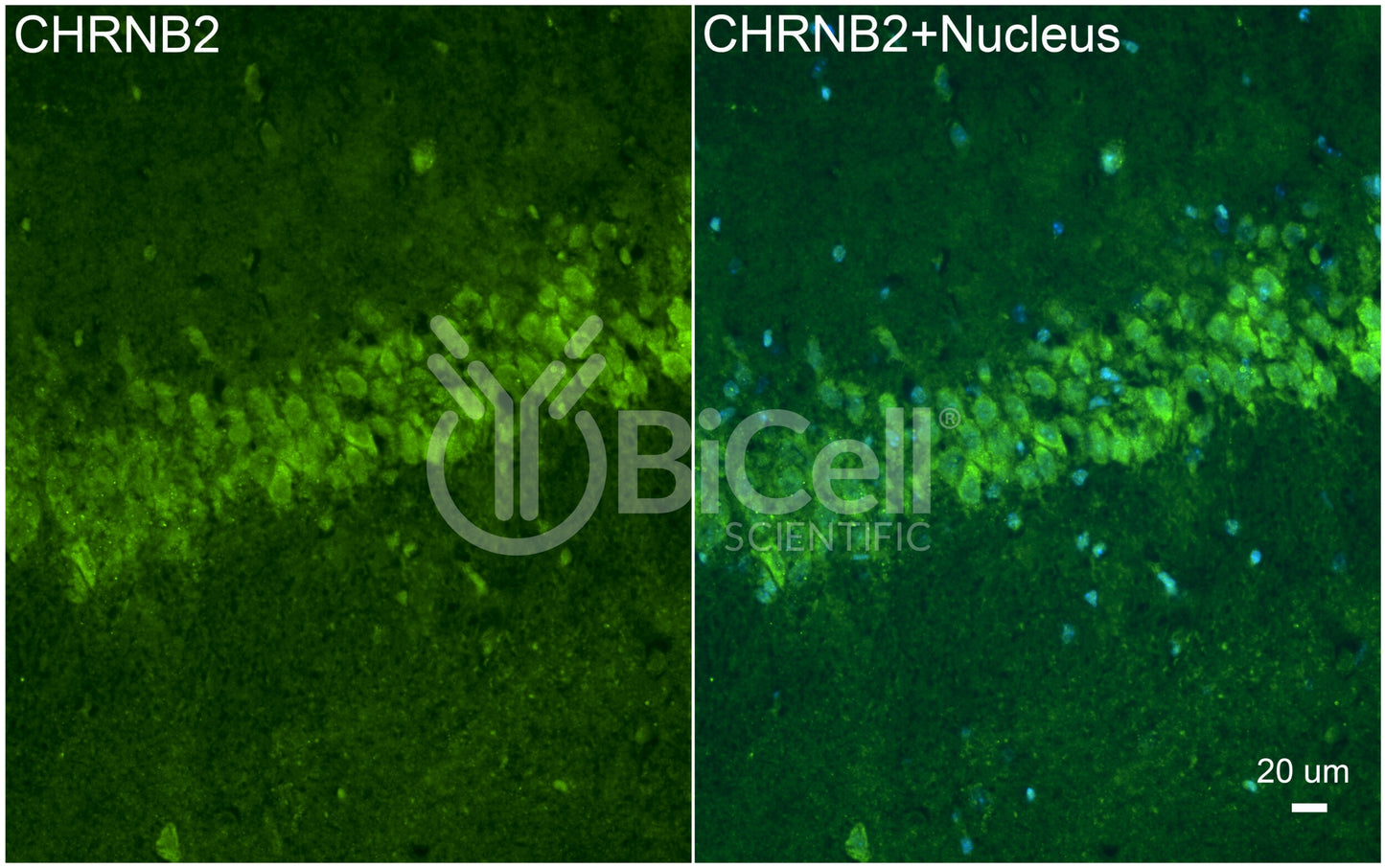 CHRNB2 (nAChRB2) Antibody - Western Blot Validated
