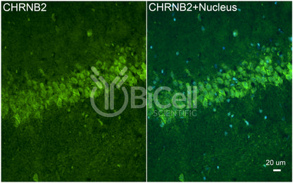 CHRNB2 (nAChRB2) Antibody - FFPE Validated