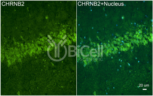 CHRNB2 (nAChRB2) Antibody