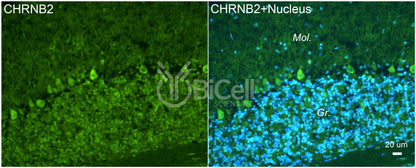 CHRNB2 (nAChRB2) Antibody - Western Blot Validated