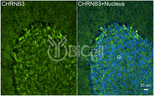 CHRNB3 Antibody