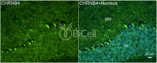 CHRNB4 Antibody - FFPE Validated