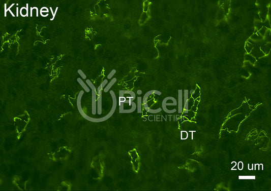 Cingulin (CGN) Antibody - FFPE Validated