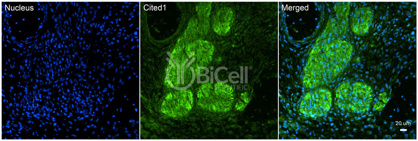 CITED1 Antibody - FFPE Validated