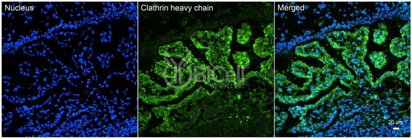 Clathrin Heavy Chain (CLTC) HiRe Antibody - FFPE Validated